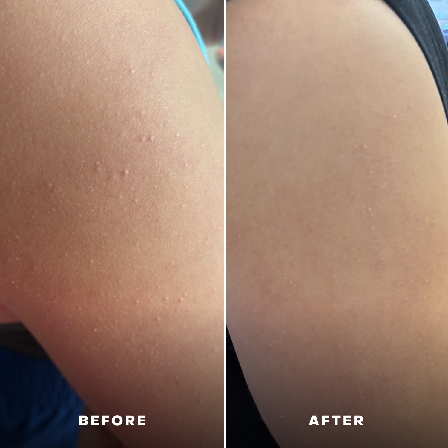 The Exfoliating Body Wash Concentrate Travel Mini