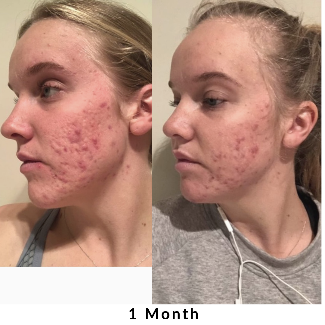 Skin + Digestion Formula