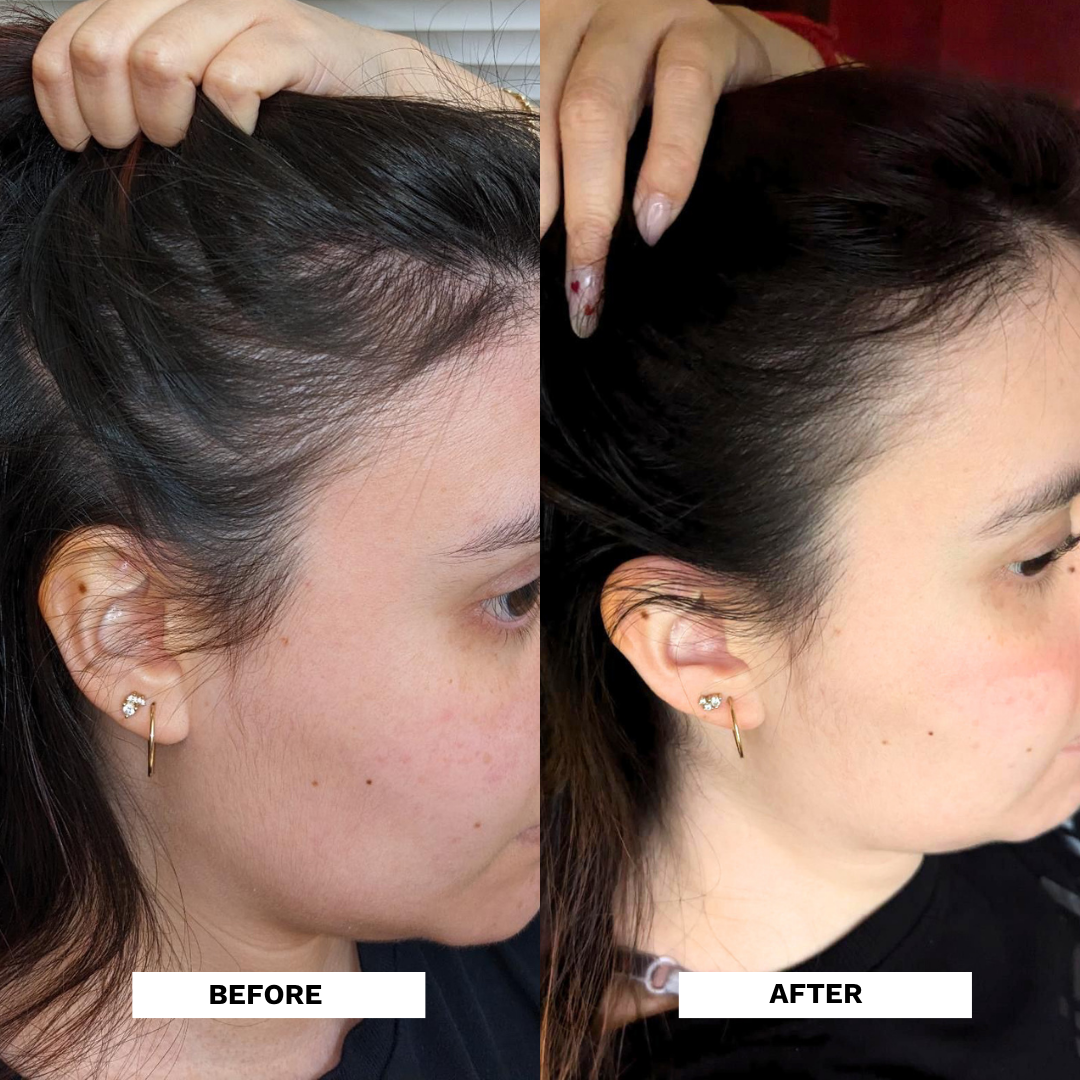 Restore Hydrating Scalp Tonic