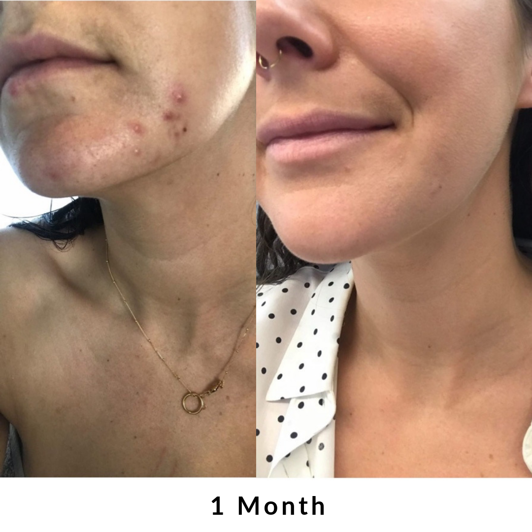 Skin + Digestion Formula