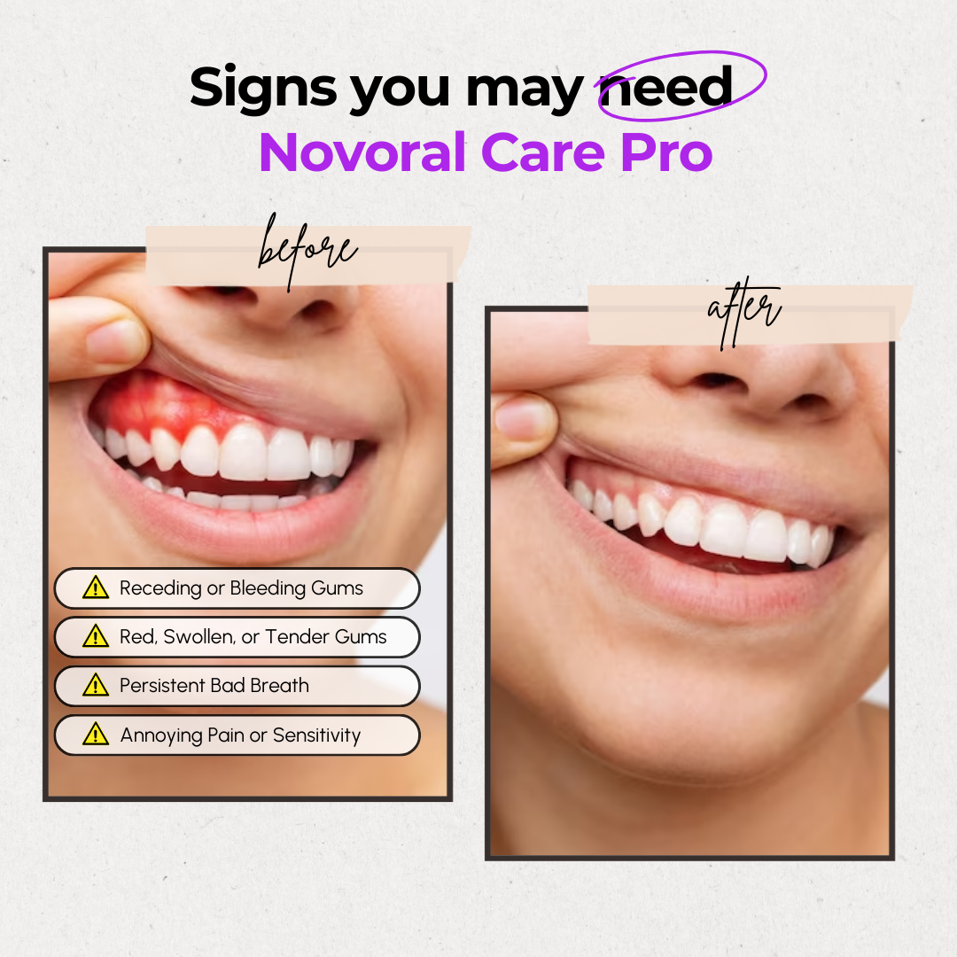 Novoral Care Pro - Oral Care at home
