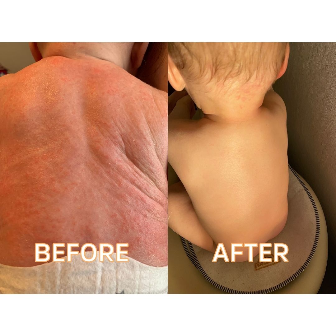 "Baby On The Way" Gift Set by FATCO Skincare Products