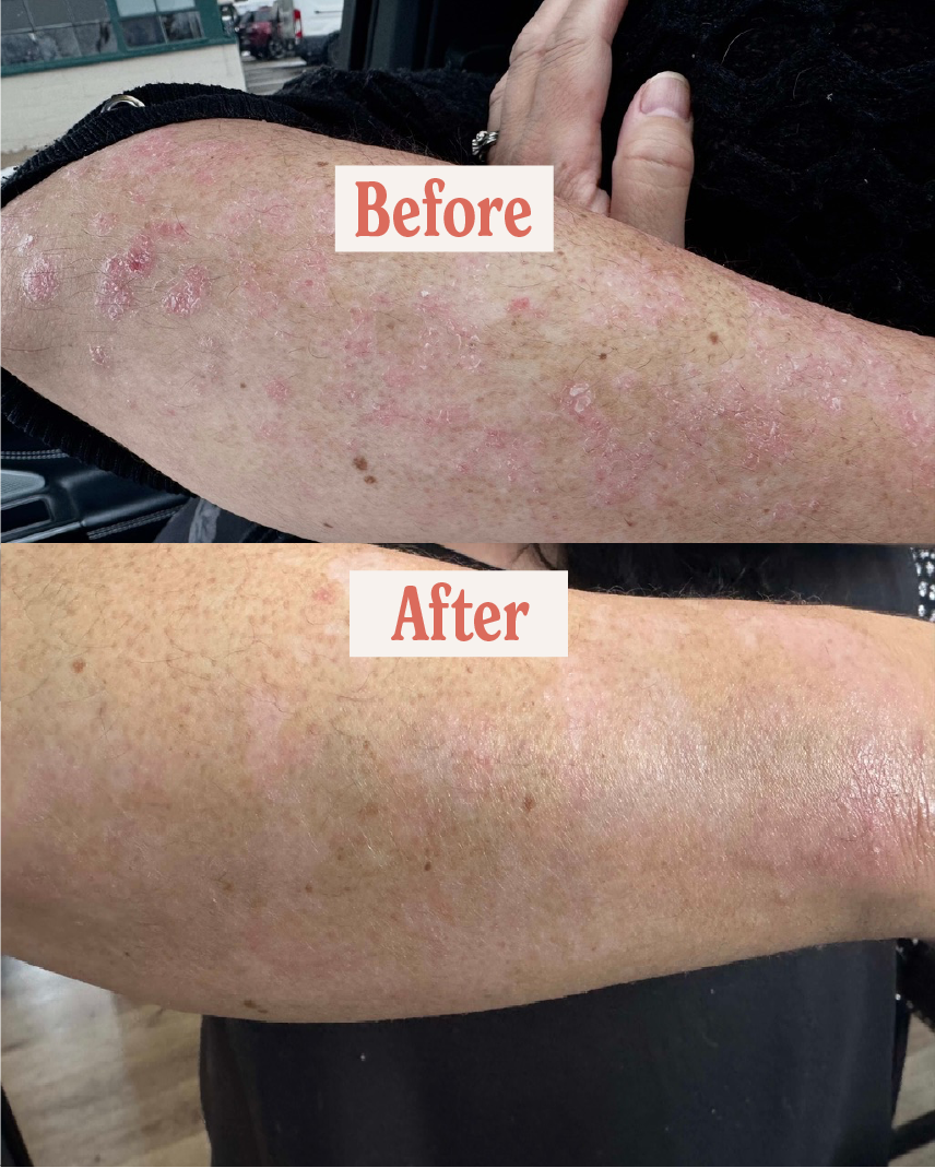 Bare Baby Tallow Butter - Natural Eczema & Diaper Rash Relief
