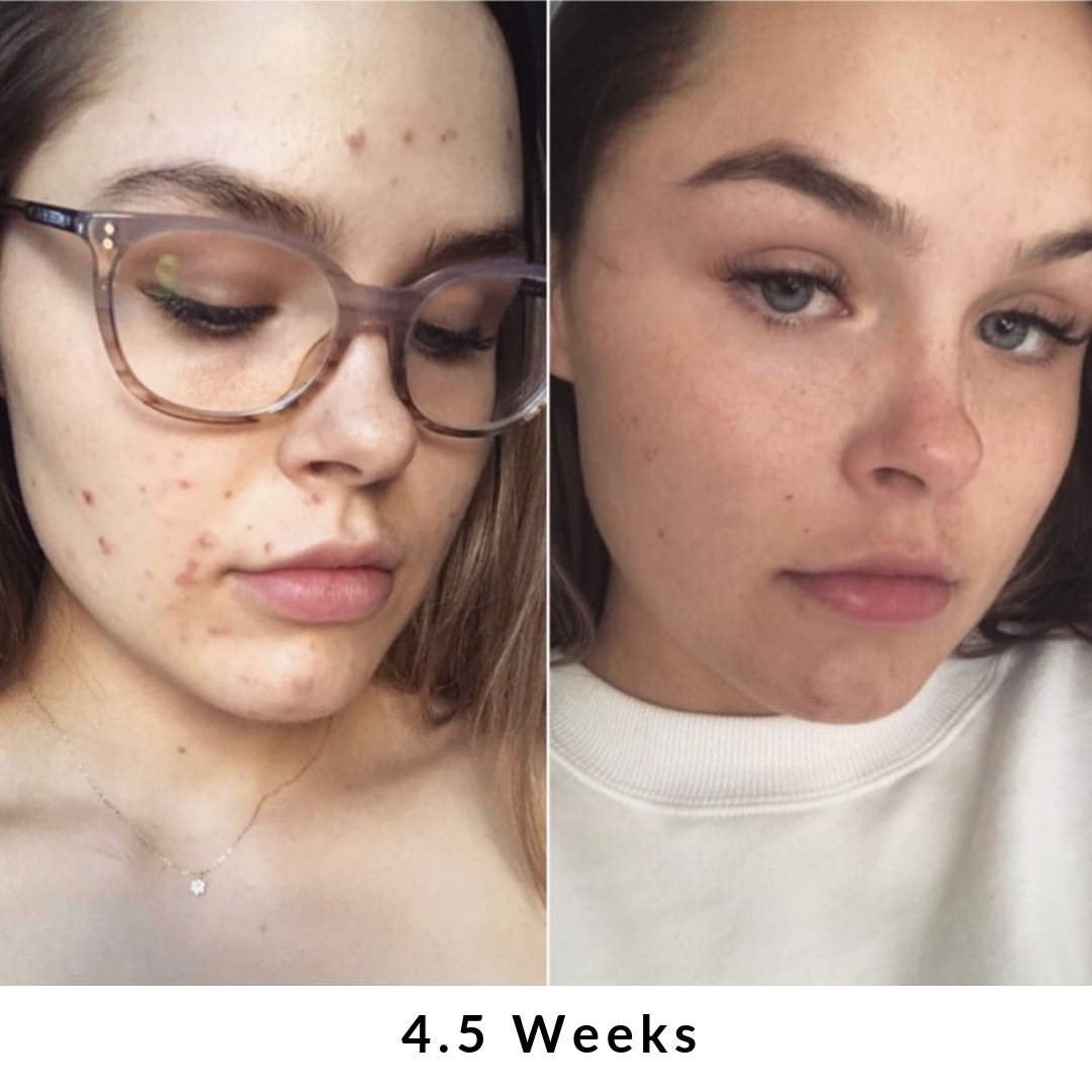 Skin + Digestion Formula
