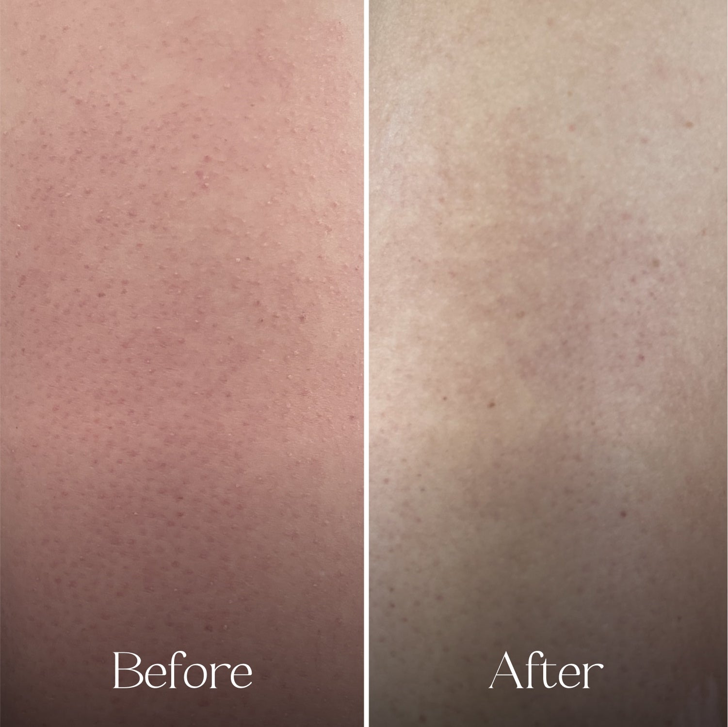 The Exfoliating Body Wash Concentrate Travel Mini