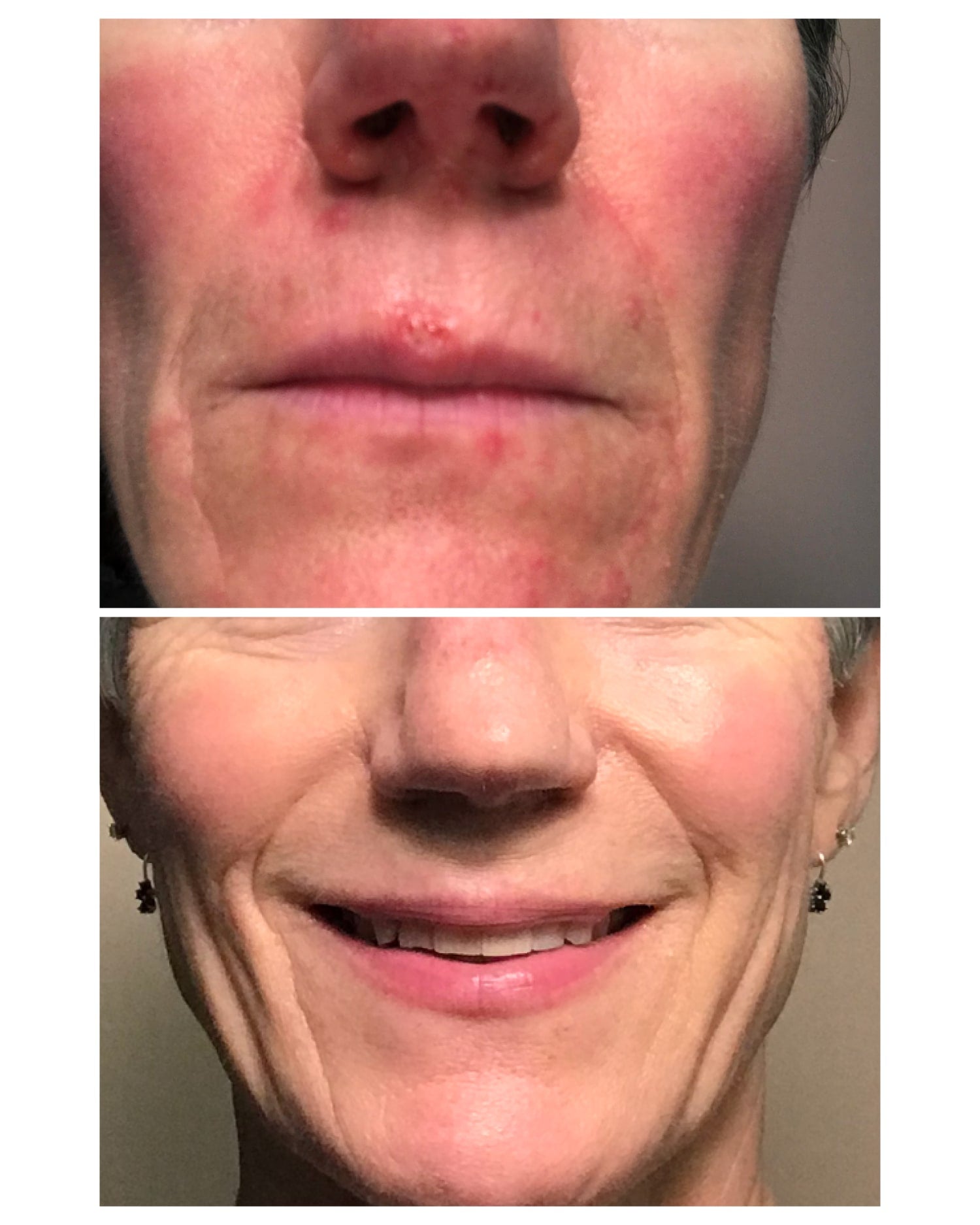 Marshmallow & Probiotic Sensitivity Soothing Cream Cleanser by Naturopathica