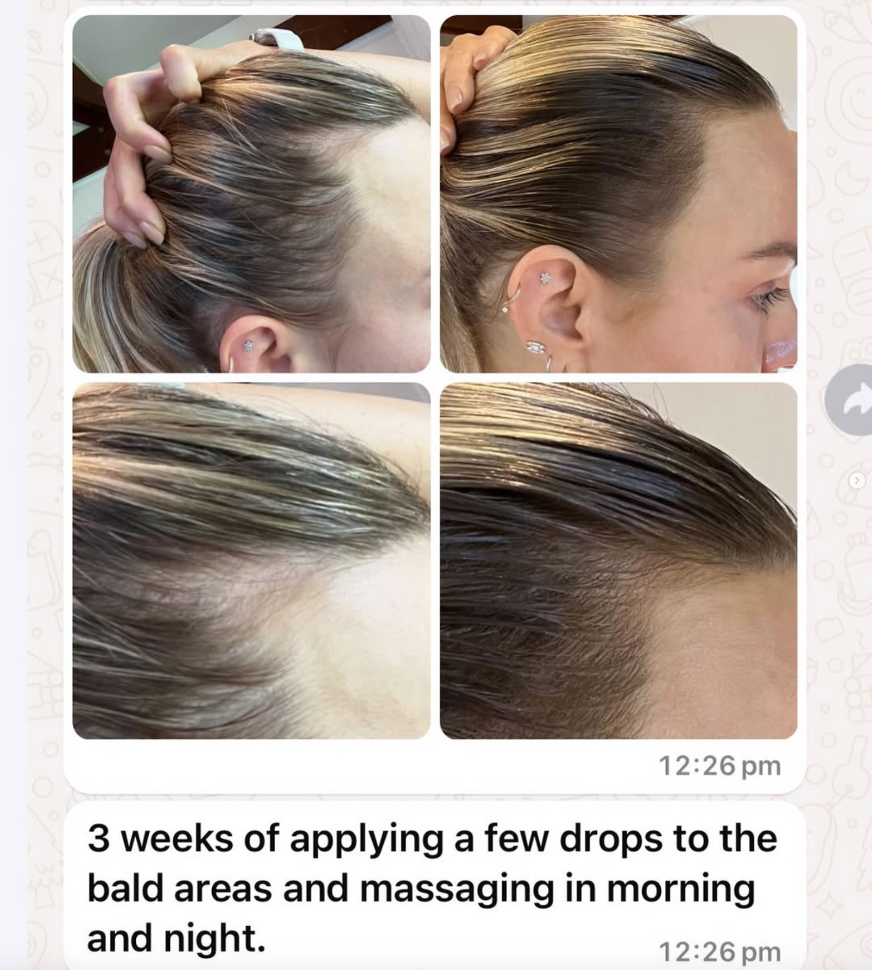 The Complete Vita-Hair System