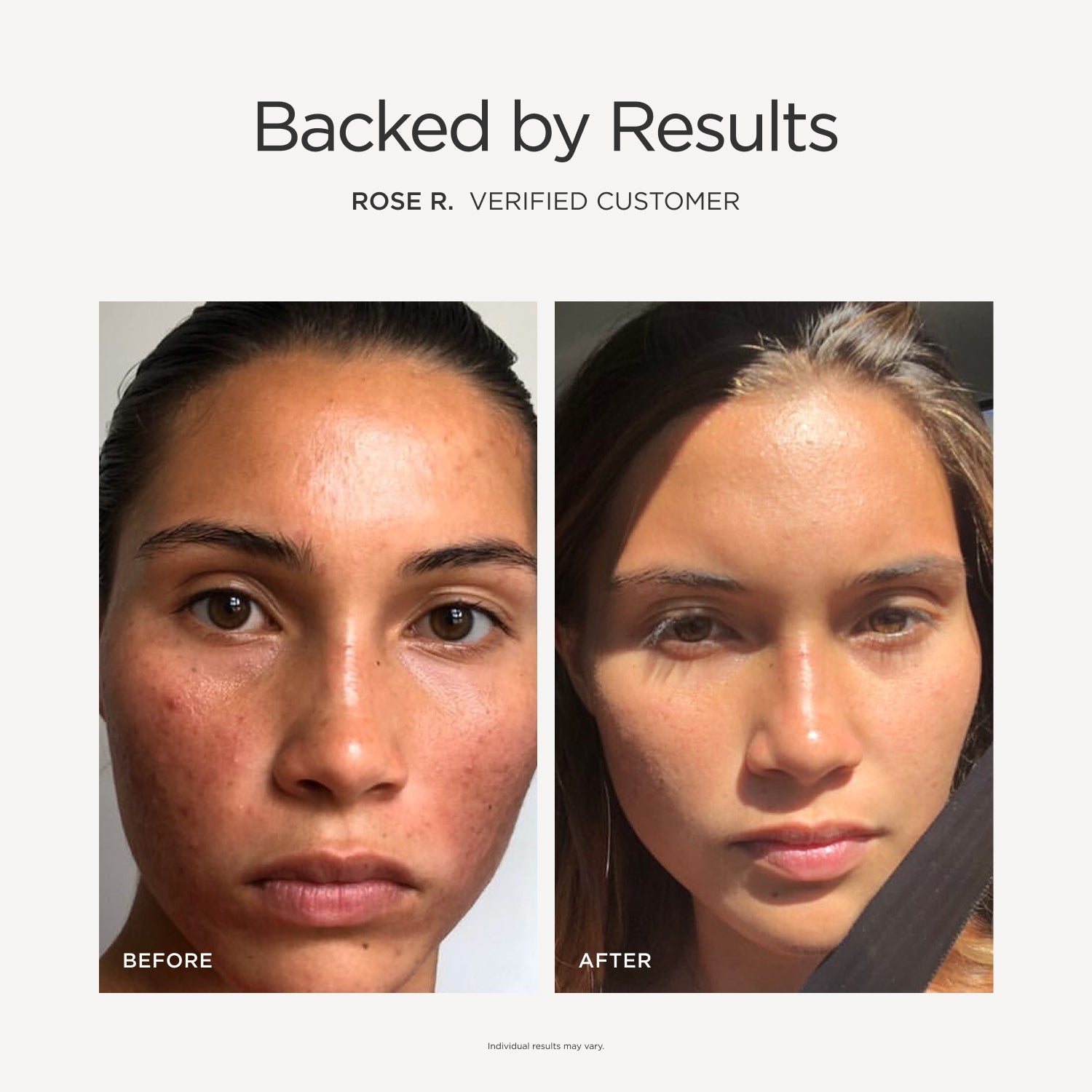 Skin + Digestion Formula