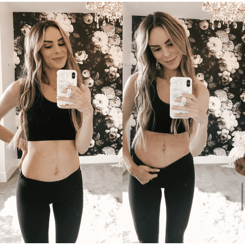 Tummy Butter Postpartum Stretch Mark Cream by The Spoiled Mama