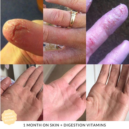 Skin + Digestion Formula