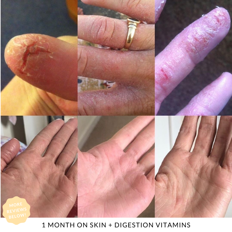 Skin + Digestion Formula