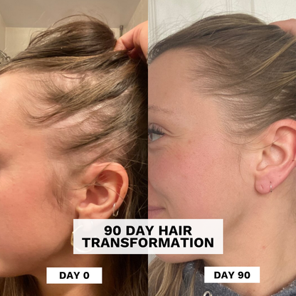 Restore Hydrating Scalp Tonic