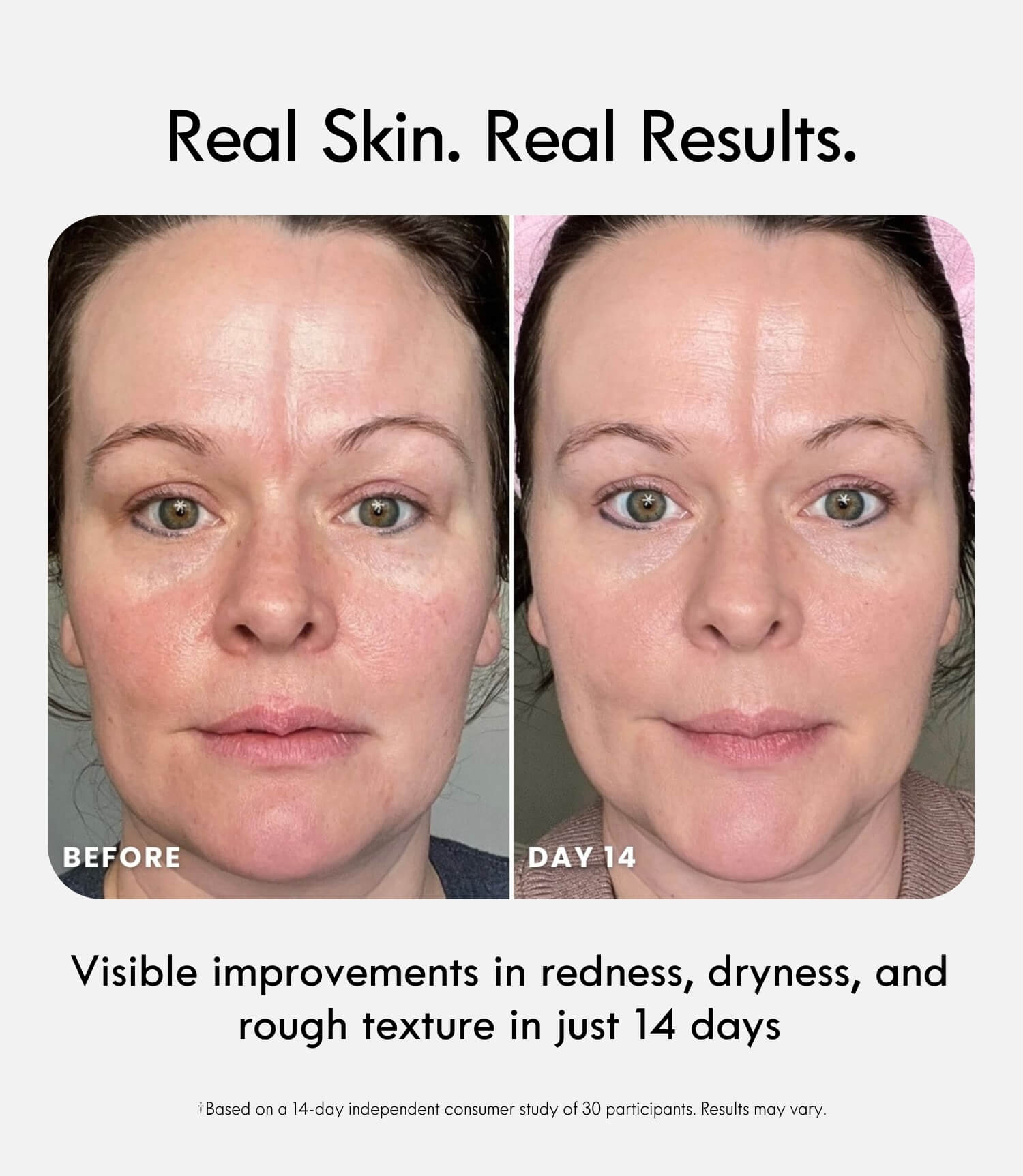 Bio-Adaptive Recovery Cream