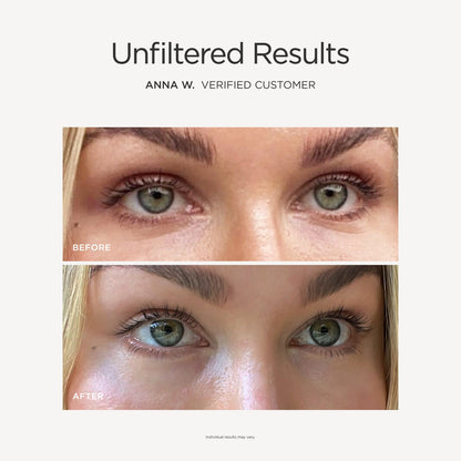 Illuminating Peptide Eye Serum
