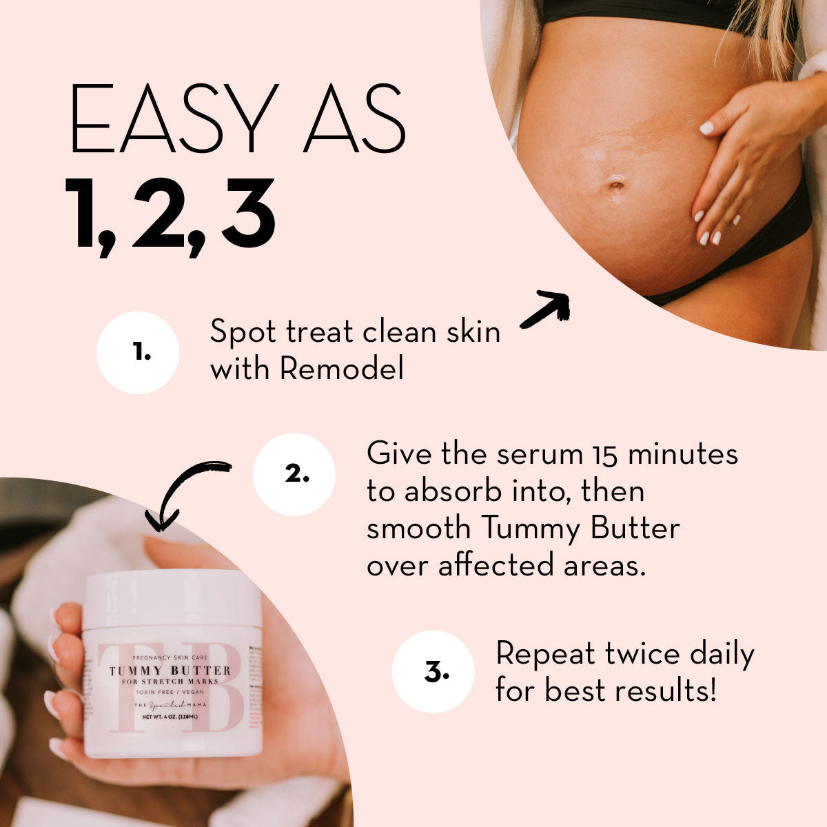 ReModel Serum: Stretch Mark Treatment by The Spoiled Mama