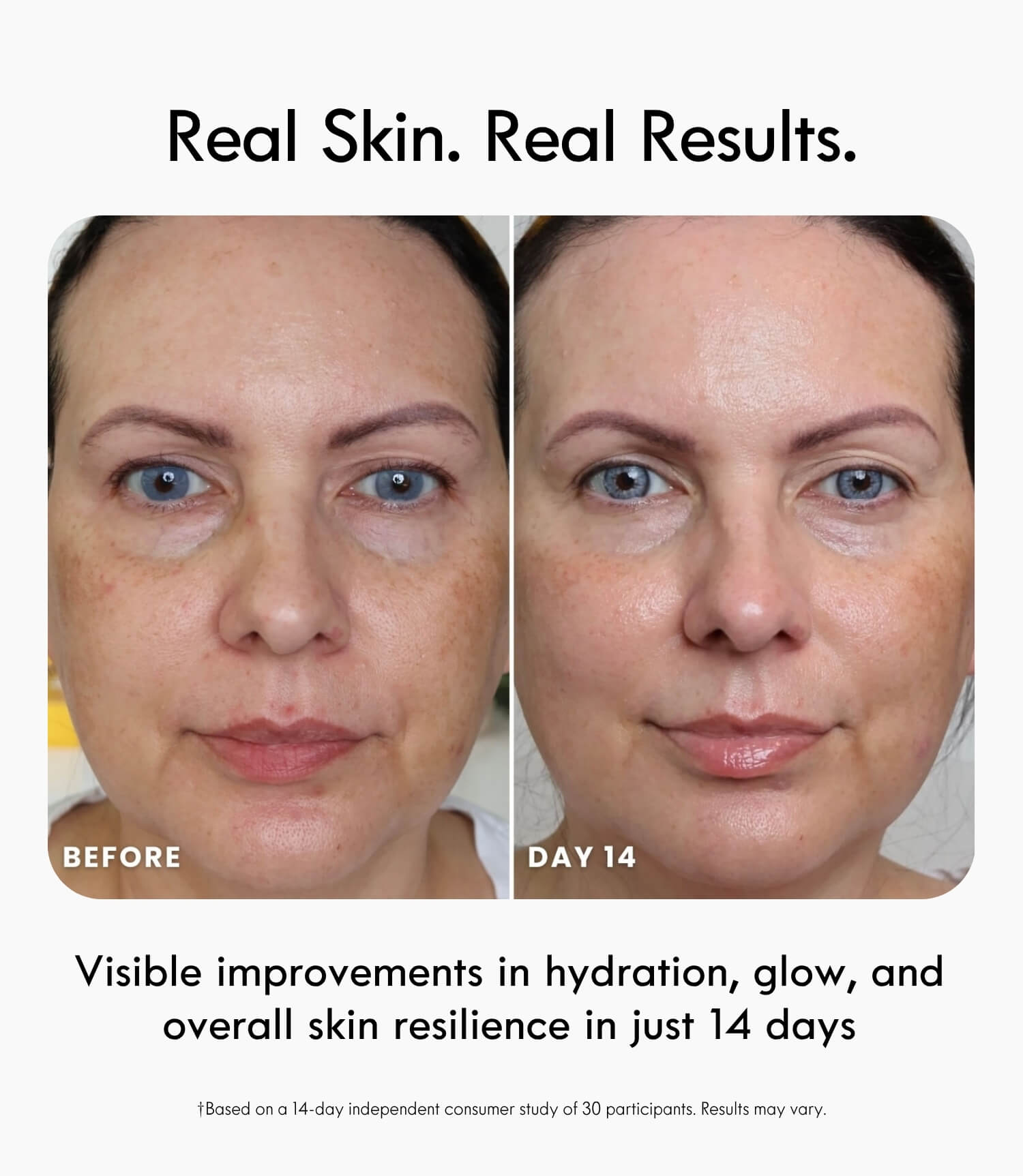 Bio-Adaptive Skin Barrier System™ – Complete Skin Barrier Recovery Set