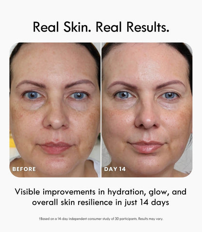 Bio-Adaptive Skin Barrier System™ – Complete Skin Barrier Recovery Set