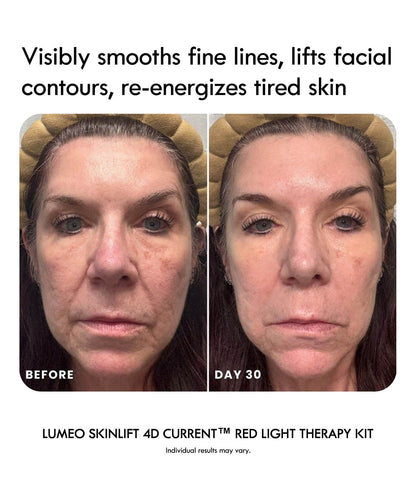 Lumeo SkinLift 4D Current™ Red Light Therapy Kit