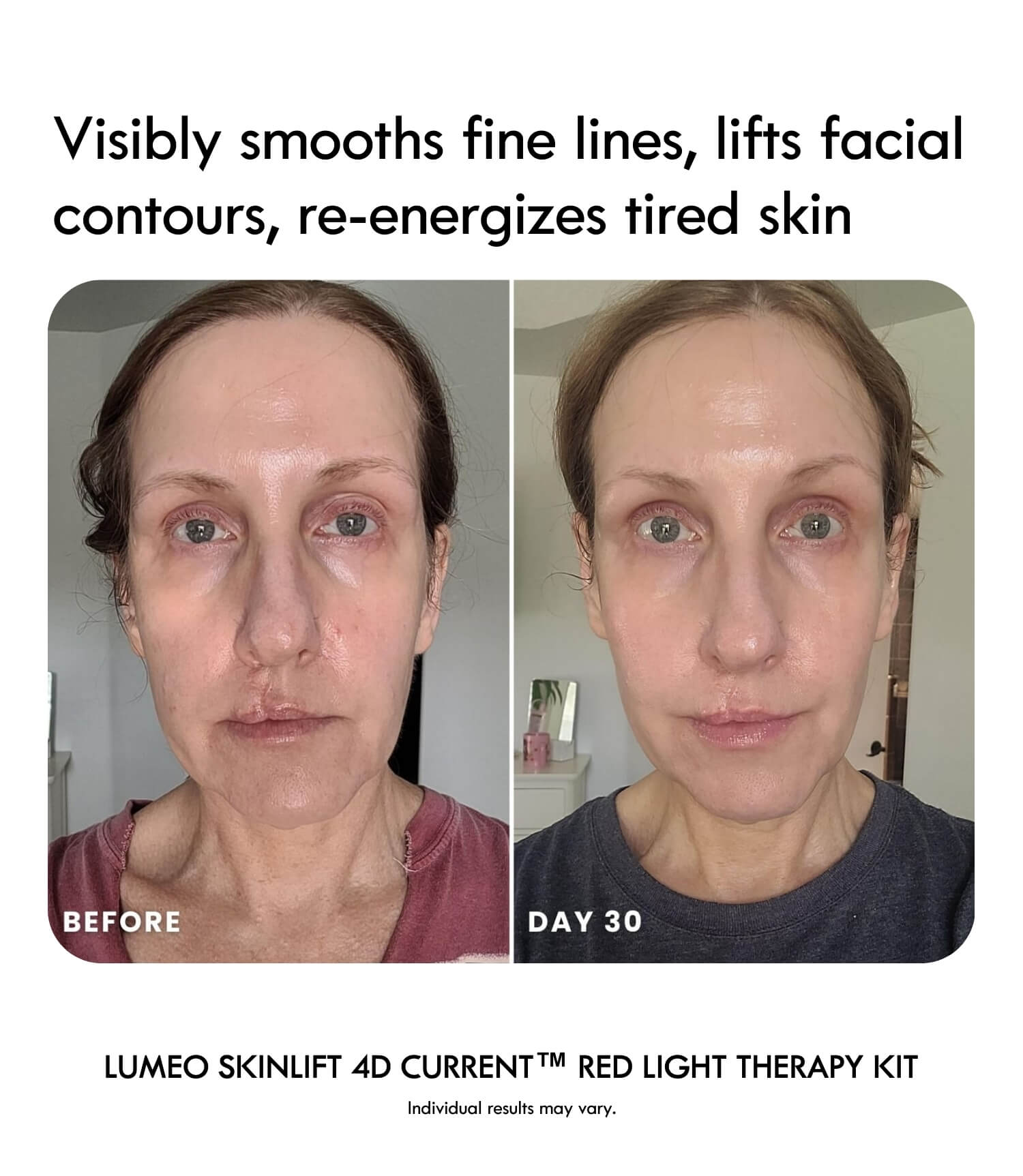 Lumeo SkinLift 4D Current™ Red Light Therapy Kit