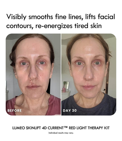 Lumeo SkinLift 4D Current™ Red Light Therapy Kit