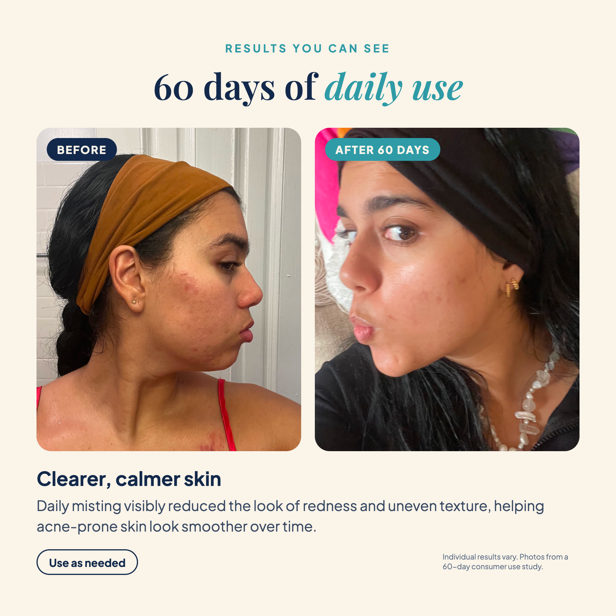 Prebiotic Natural Skin Repair Mist