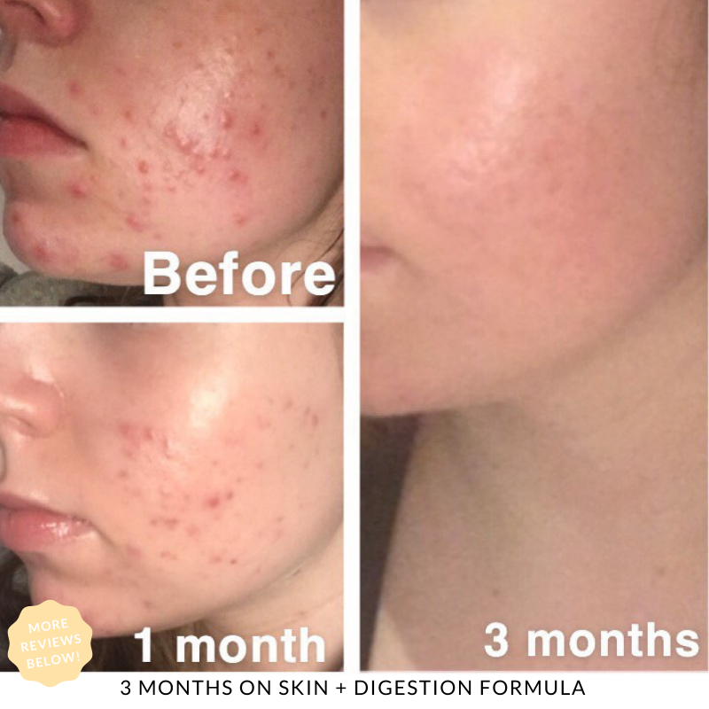 Skin + Digestion Twin Pack - 2 Months Supply