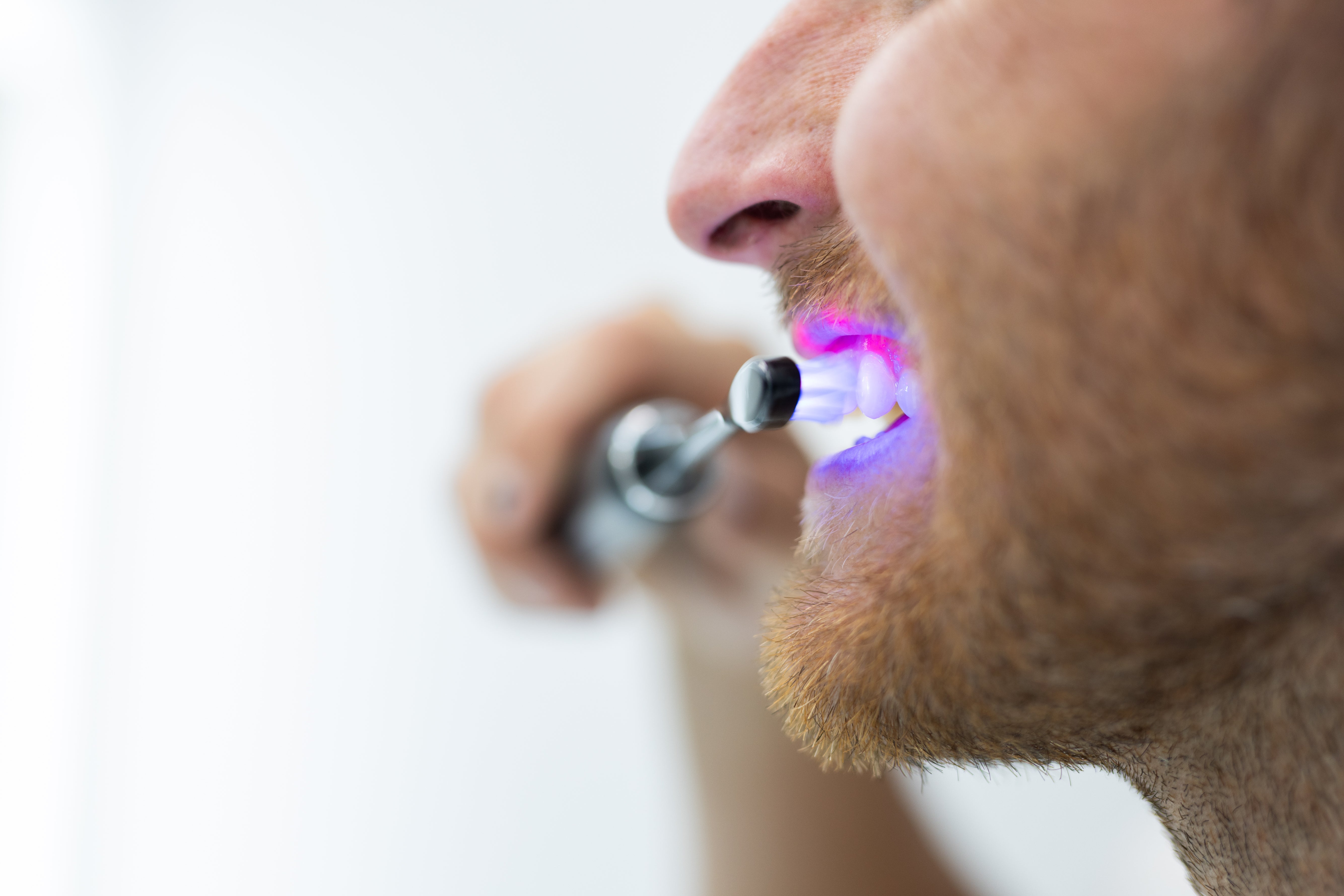Illume Sonic Toothbrush With Red & Blue Light Therapy For Maximum Oral Health Benefits