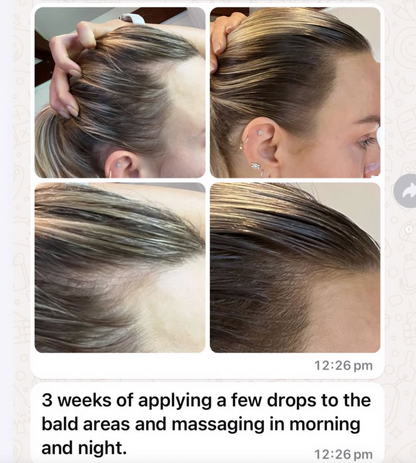 Vita-Growth Scalp Serum - 50ml