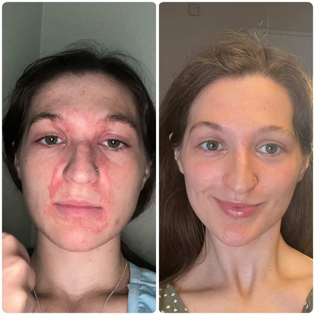 Lumière Barrier Repair Balm