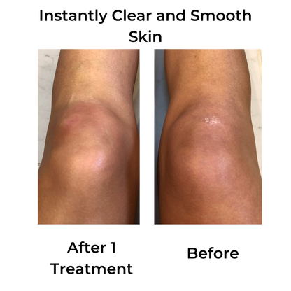 Lucky Skin Hydro and Hydrating Blend Solution Bundle by Lucky Skin