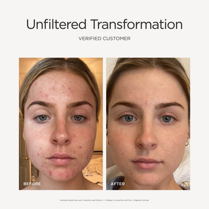 Vitality X + Collagen - 30 packets