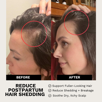 The Scalp Reset Trio