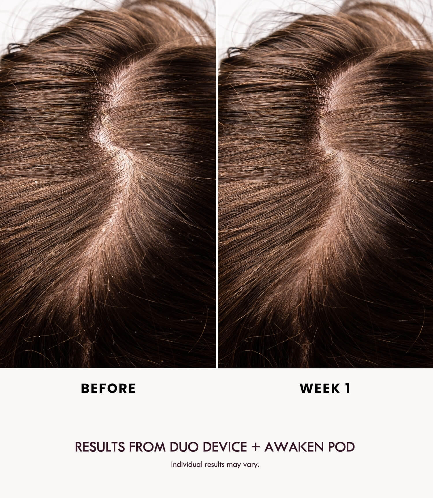 AWAKEN DUO POD