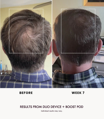 BOOST DUO POD
