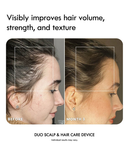 Laduora DUO 4-in-1 Red Light Therapy Hair & Scalp Care Device