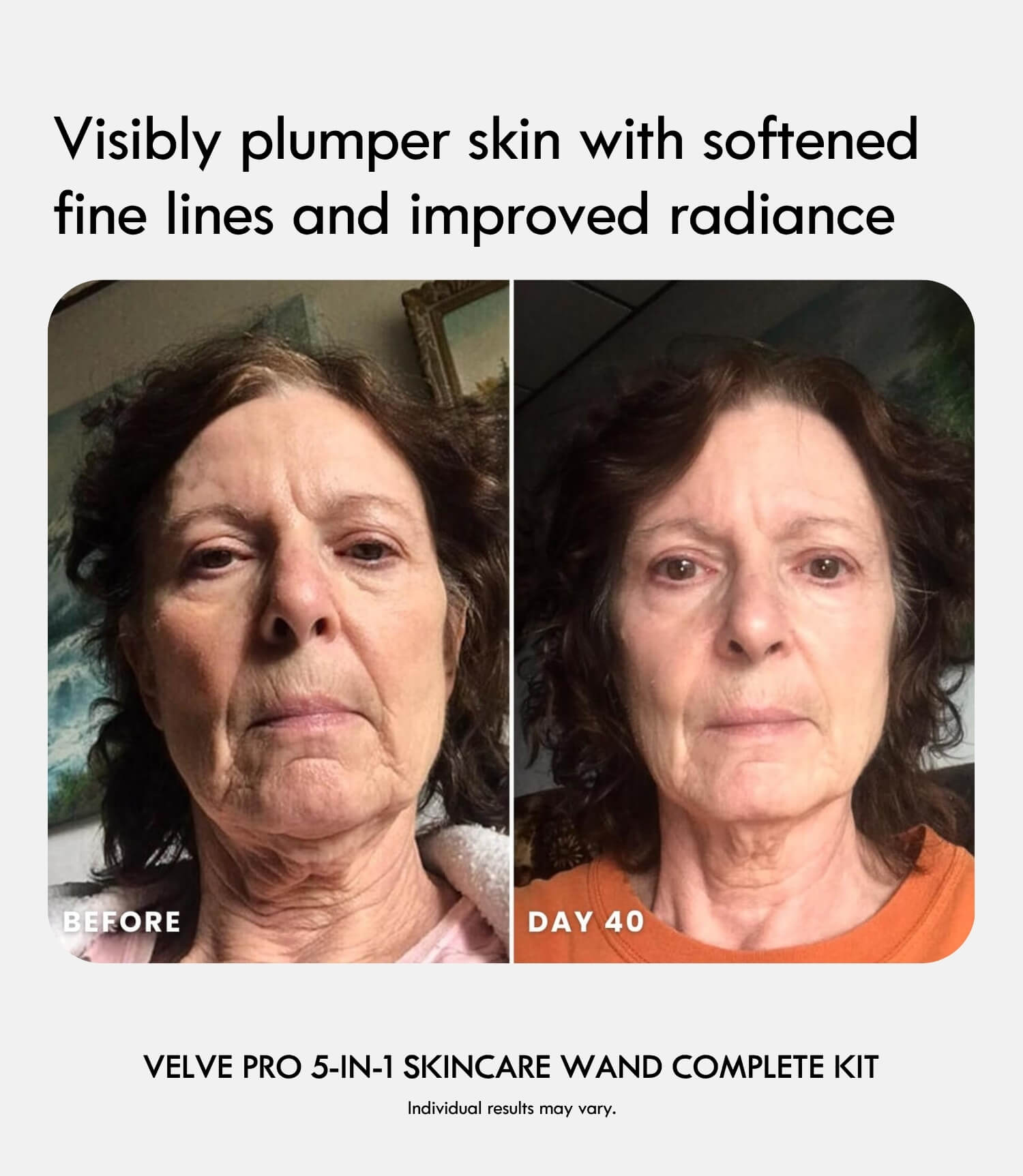Velve Pro 5-in-1 Skincare Wand Complete Kit