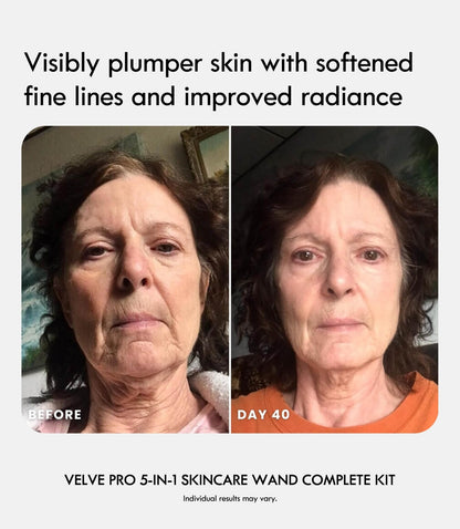Velve Pro 5-in-1 Skincare Wand Complete Kit